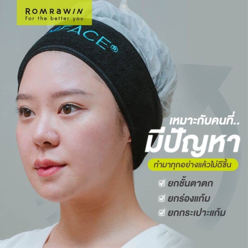 Emface นวัตกรรมยกกระชับ
