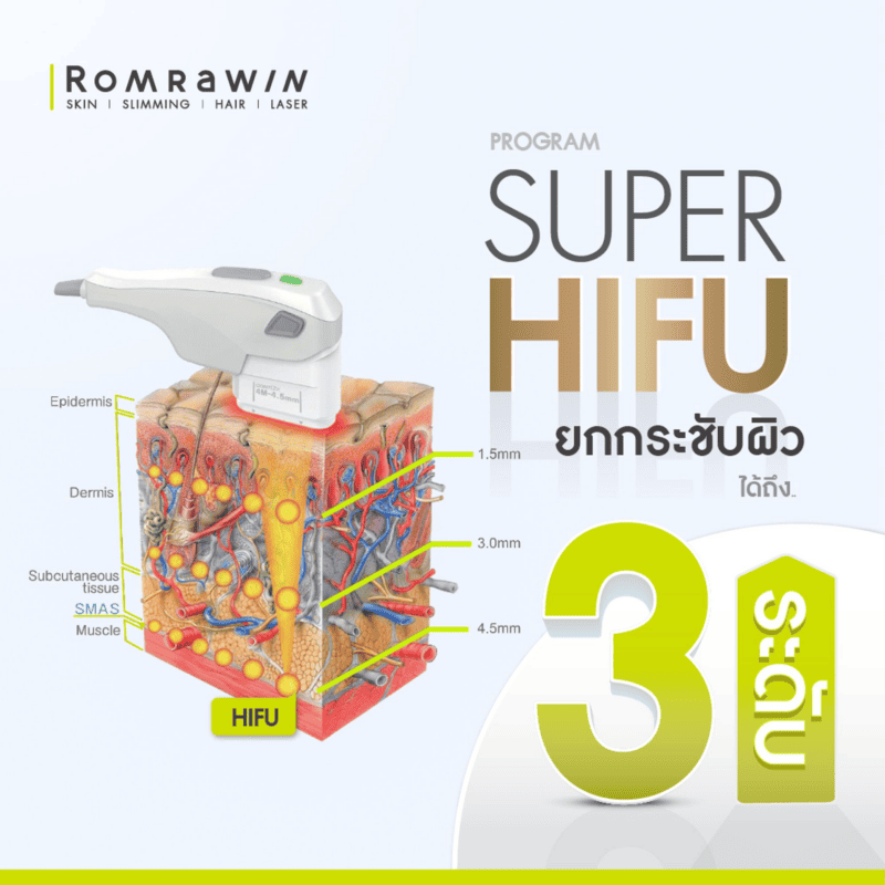 เครื่องทำ Hifu เทคโนโลยี Ultraformer III