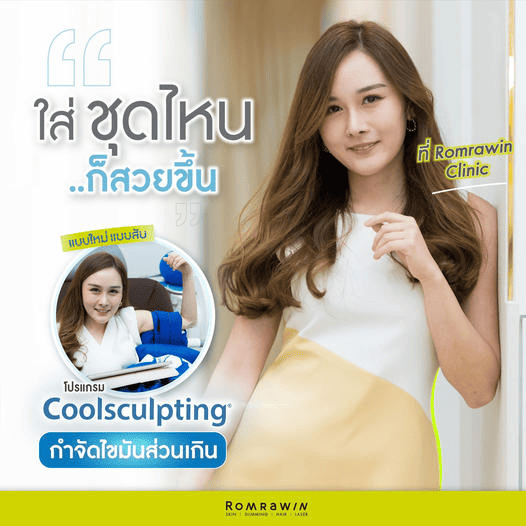 Coolsculpting รีวิว ต้น แขน