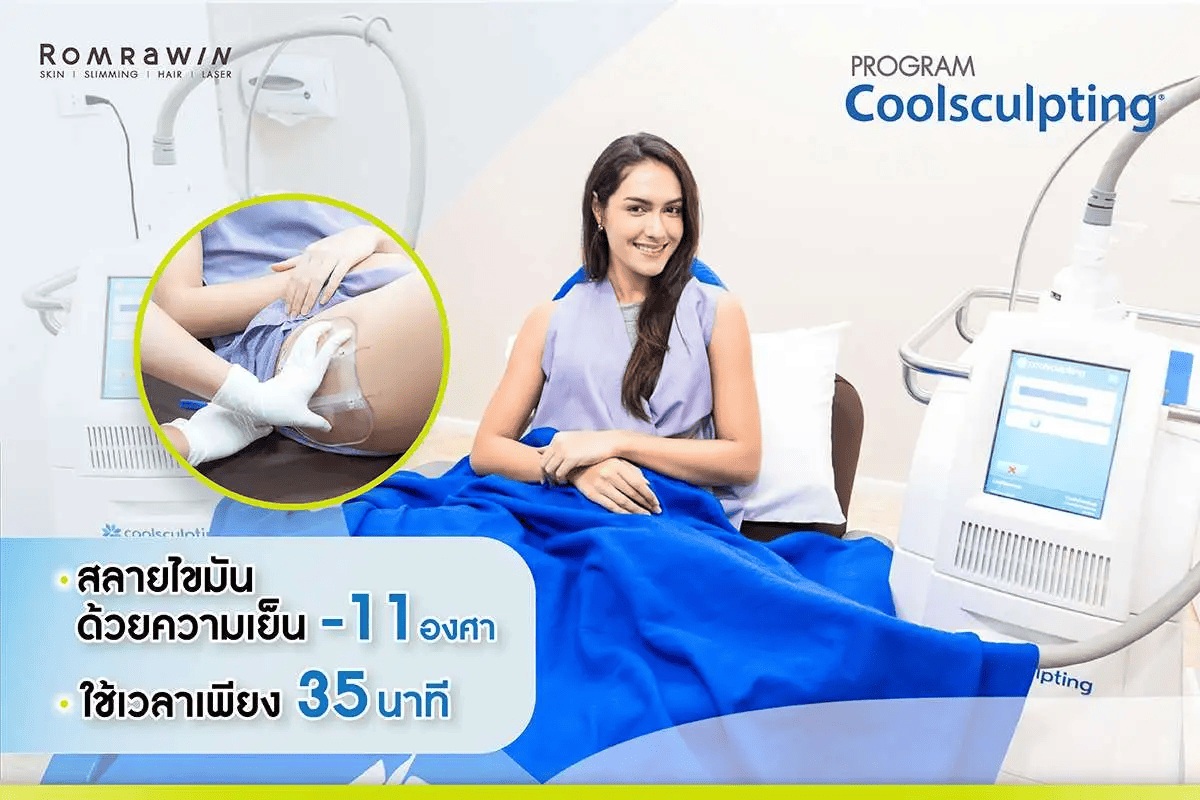 Coolsculpting เหนียง