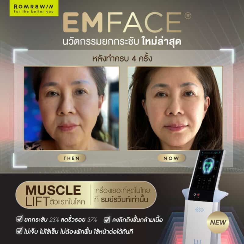 ผลลัพธ์ Emface