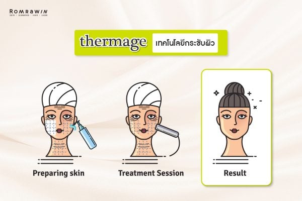 Thermage แตกต่าง Ulthera