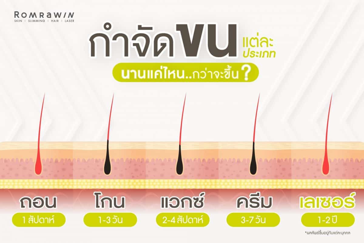 วิธีกำจัดขนแต่ละประเภทและเลเซอร์ขน