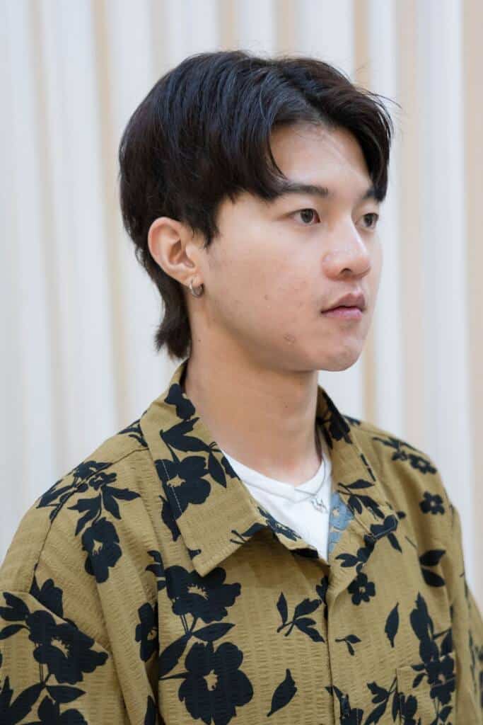 ฉีดฟิลเลอร์ร่องแก้มรีวิว