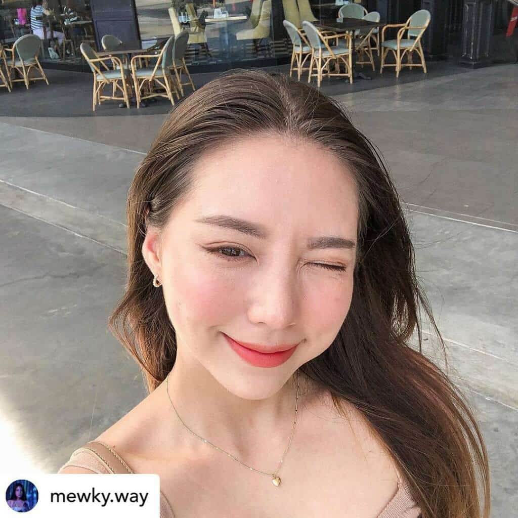 ฉีดแฟตแก้มอยู่ได้กี่เดือน