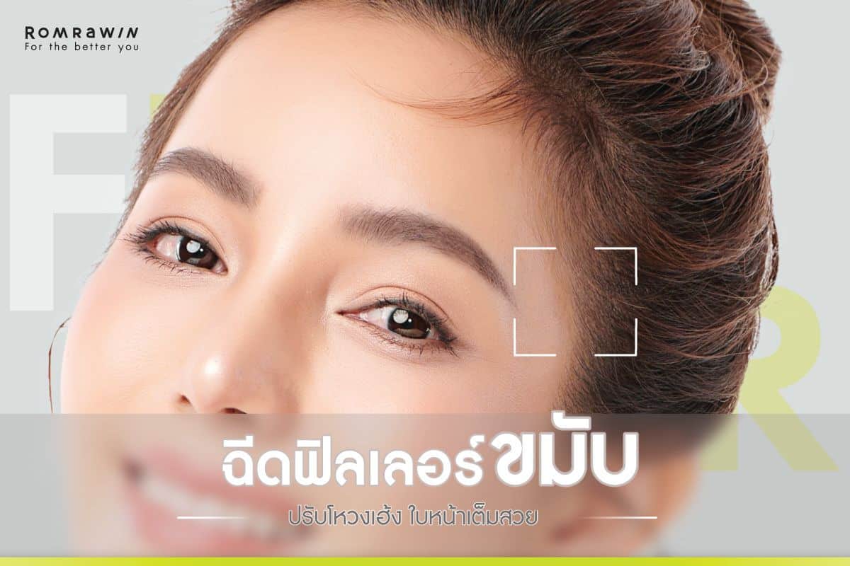 ฟิลเลอร์ขมับ