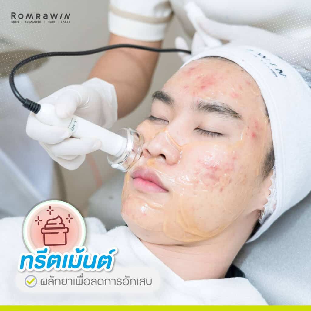 ทรีทเม้นท์หน้า คืออะไร
