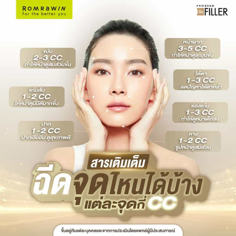 ฟิลเลอร์ร่องแก้ม