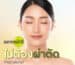 ฟิลเลอร์คาง ราคา