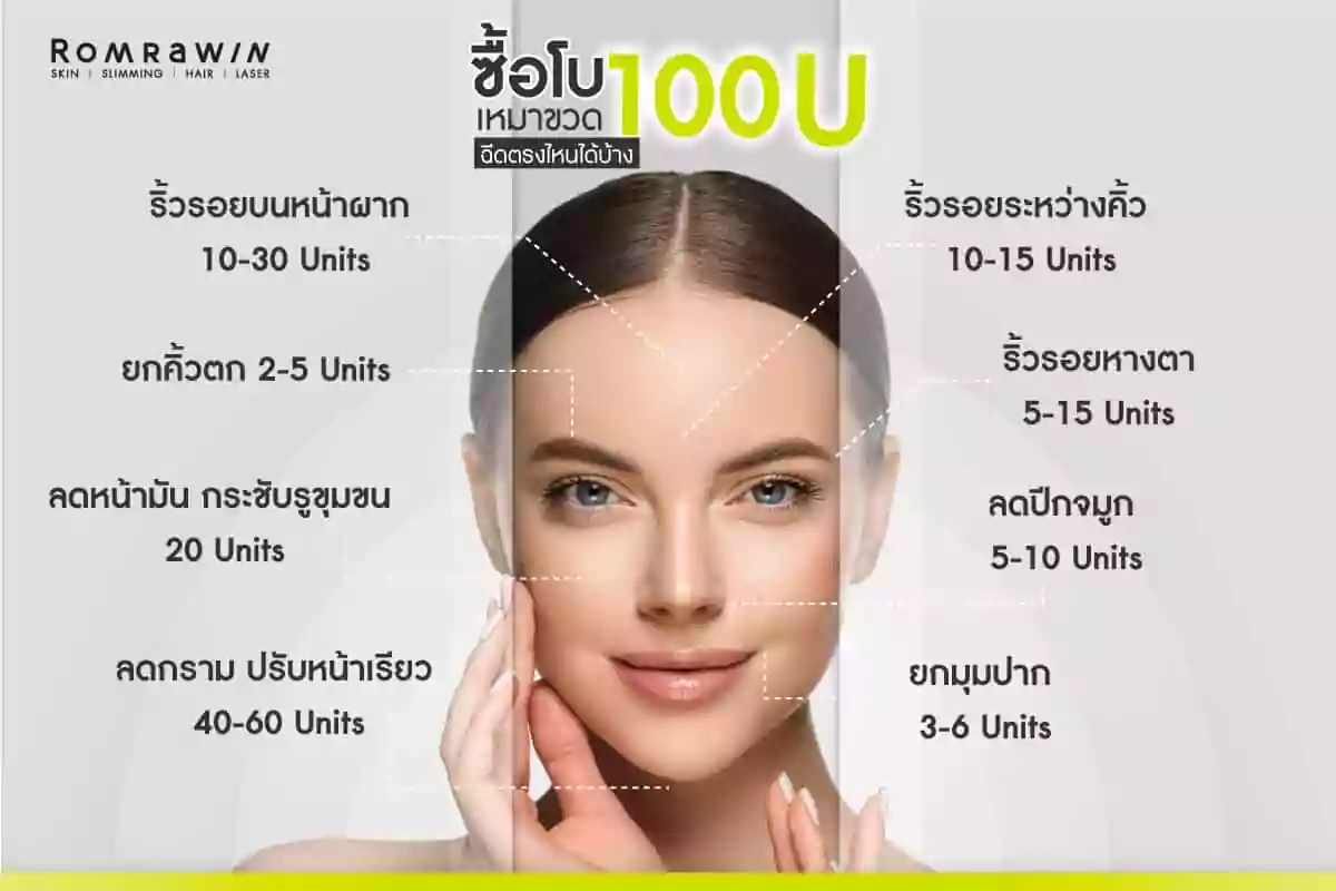 รีวิวฉีดโบท็อกลดริ้วรอย