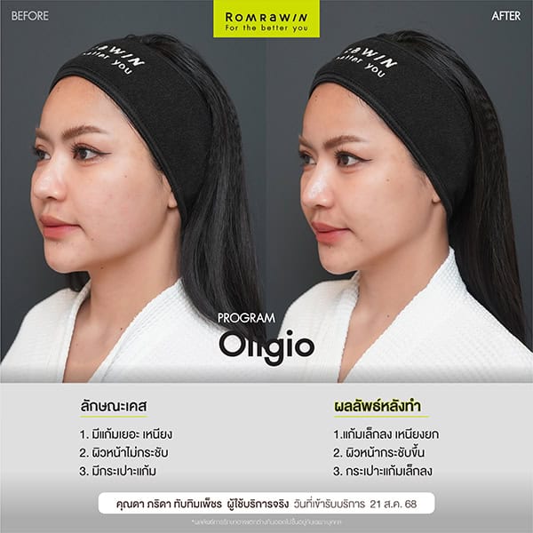 ผลลัพธ์ขึ้นอยู่กับแต่ละบุคคล