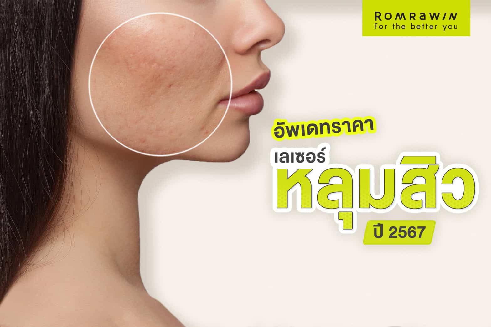 เลเซอร์หลุมสิว ราคา