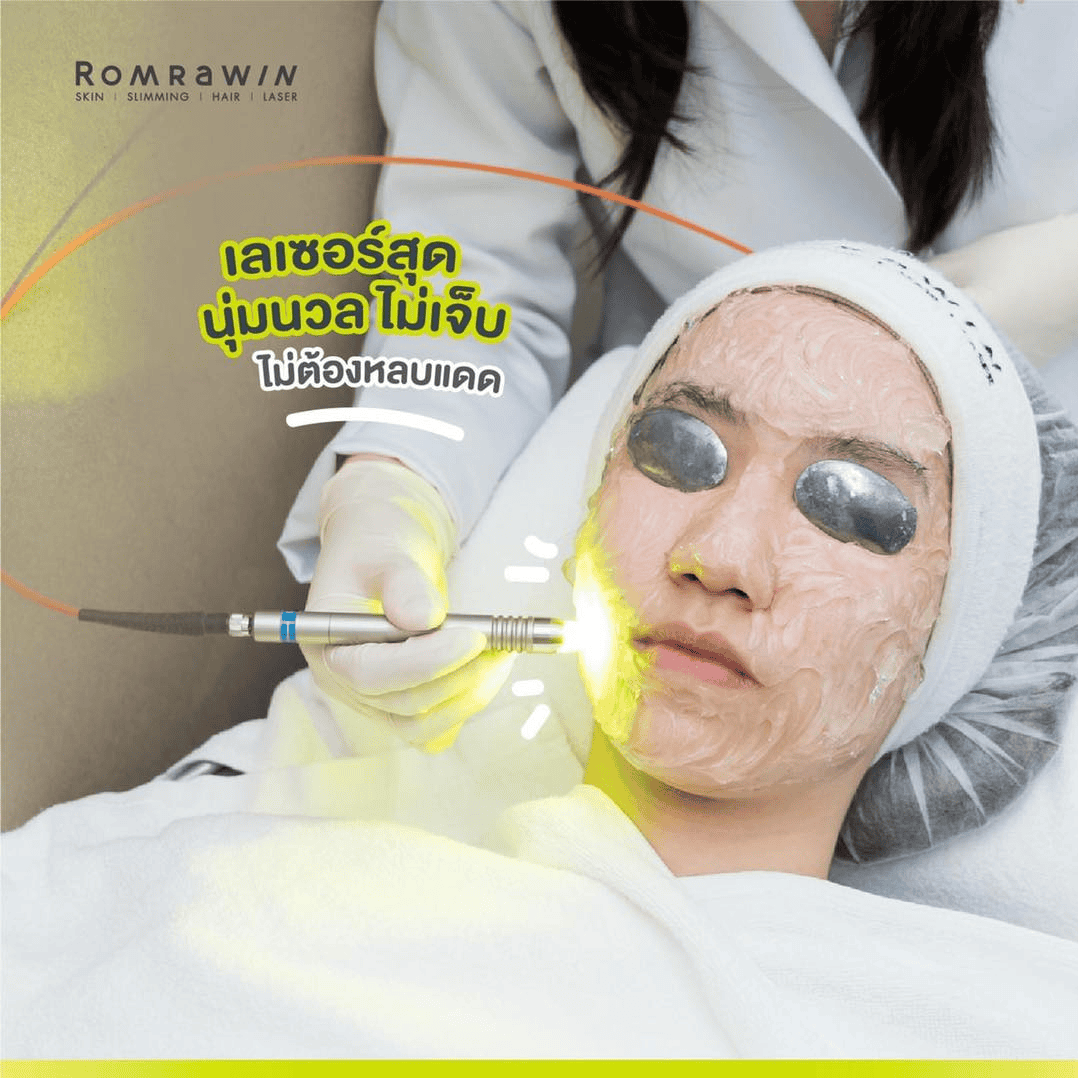 หลังทำ dual yellow laser
