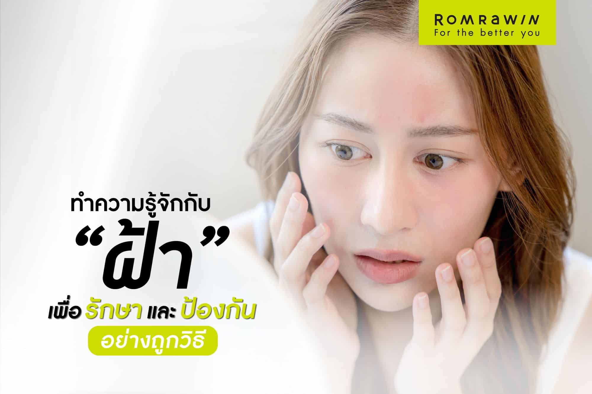ฝ้า