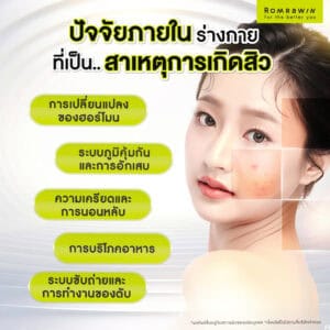 ปัจจัยภายในร่างกายที่เป็นสาเหตุการเกิดสิว
