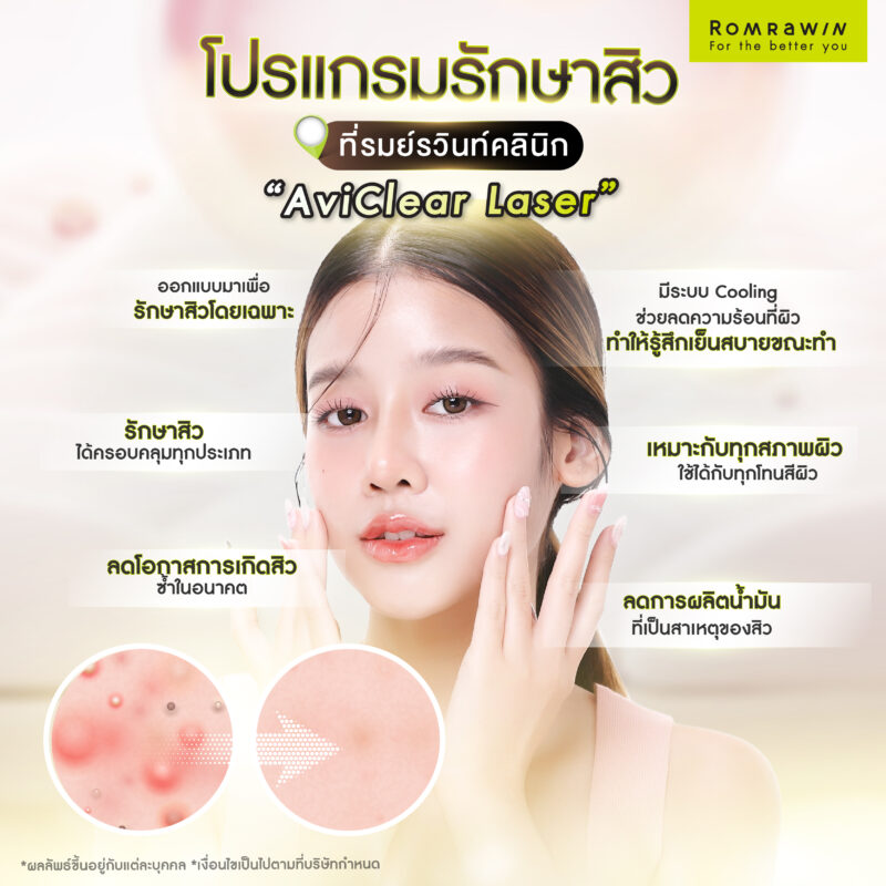 AviClear Laser 