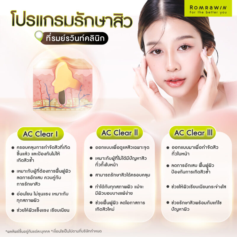 โปรแกรมรักษาสิวที่รมย์รวินท์คลินิก