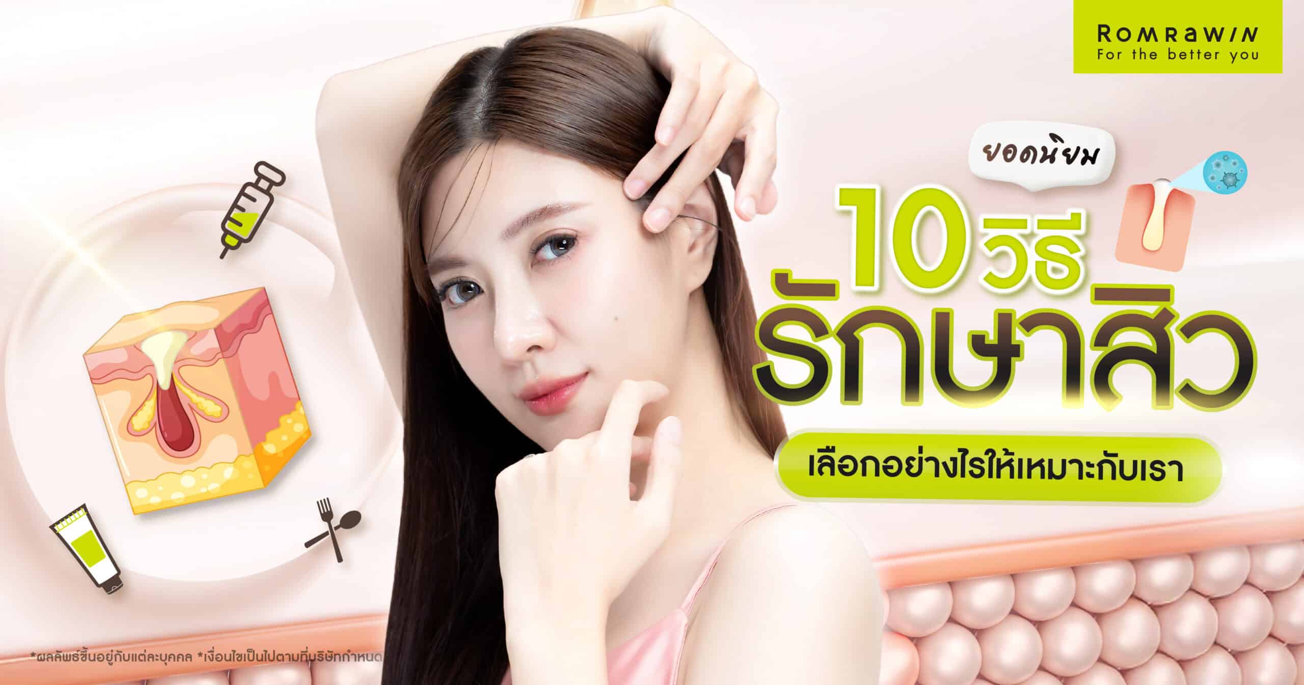 วิธีรักษาสิว