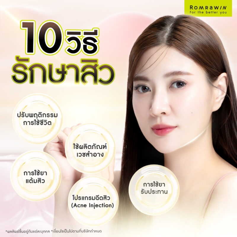 10 วิธีรักษาสิว