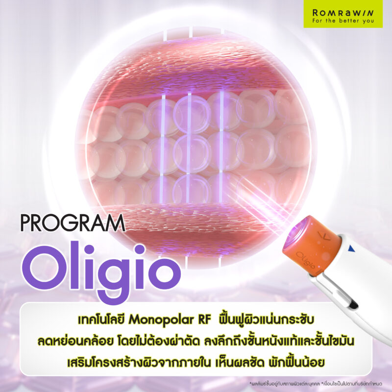 Oligio คืออะไร? โปรแกรมยกกระชับผิวที่หลายคนไว้ใจ