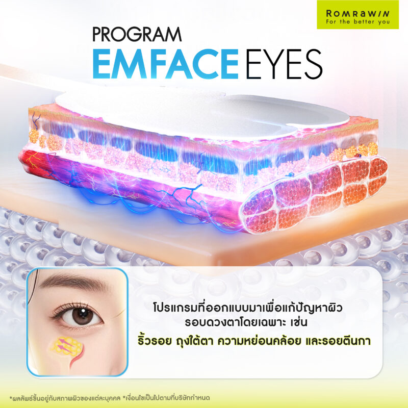 ยกกระชับรอบดวงตา EMFACE Eyes เพื่อผิวใต้ตาเรียบเนียน