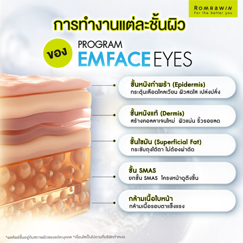 การทำงานในแต่ละชั้นผิวของ EMFACE Eyes ยกกระชับรอบดวงตา