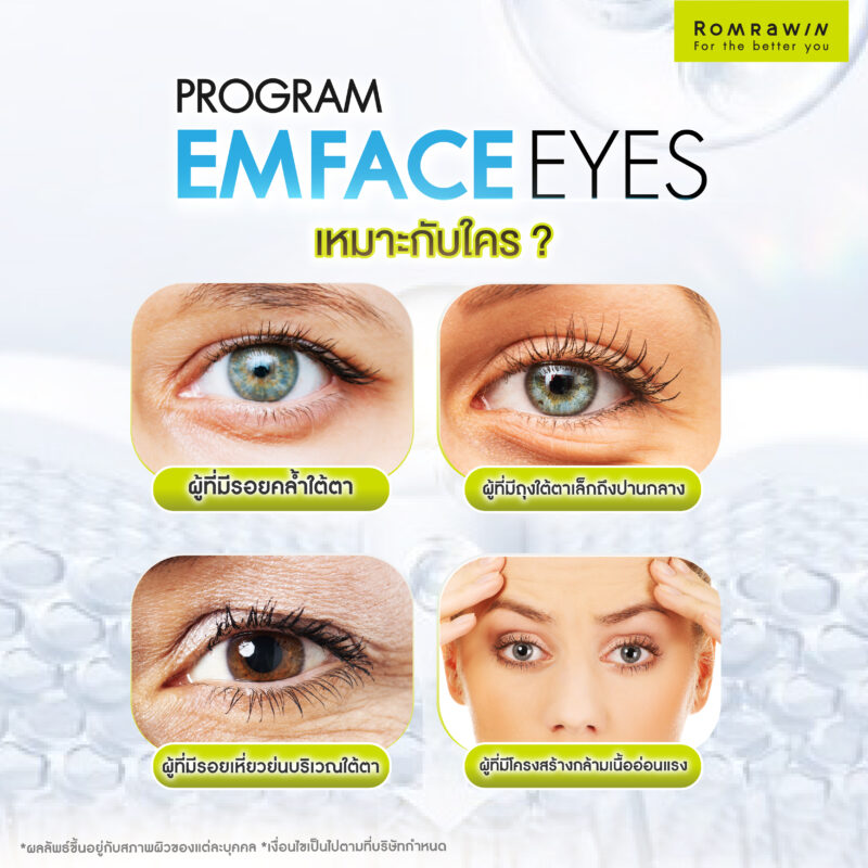 ใครบ้างที่ควรทำ EMFACE Eyes ยกกระชับรอบดวงตา?