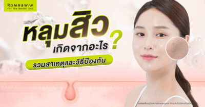 รักษาหลุมสิว