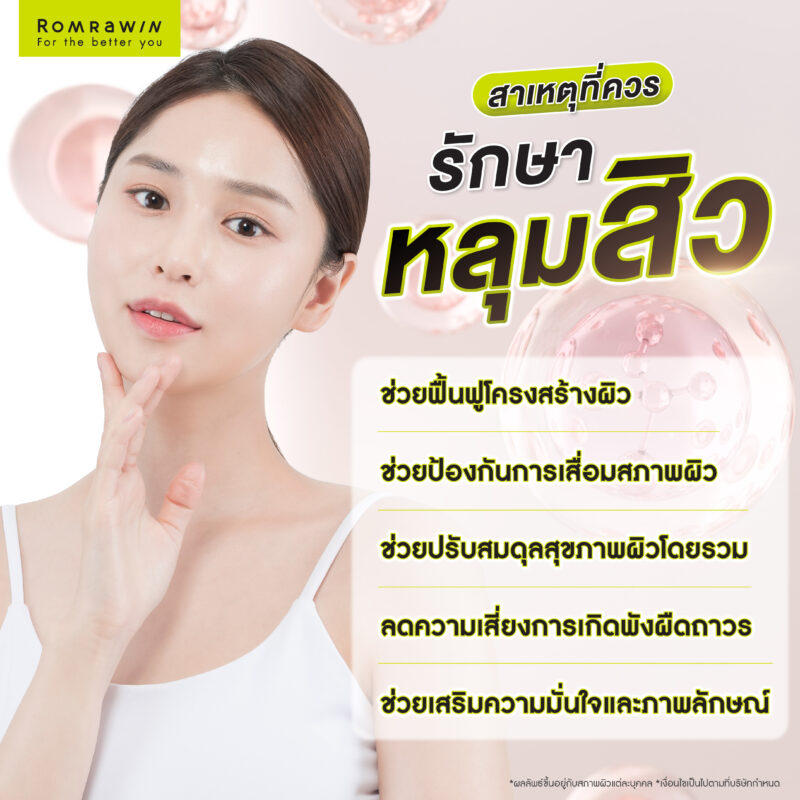 สาเหตุที่ควรรักษาหลุมสิว