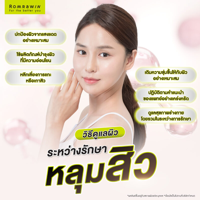 วิธีดูแลรักษาผิวระหว่างรักษาหลุมสิว