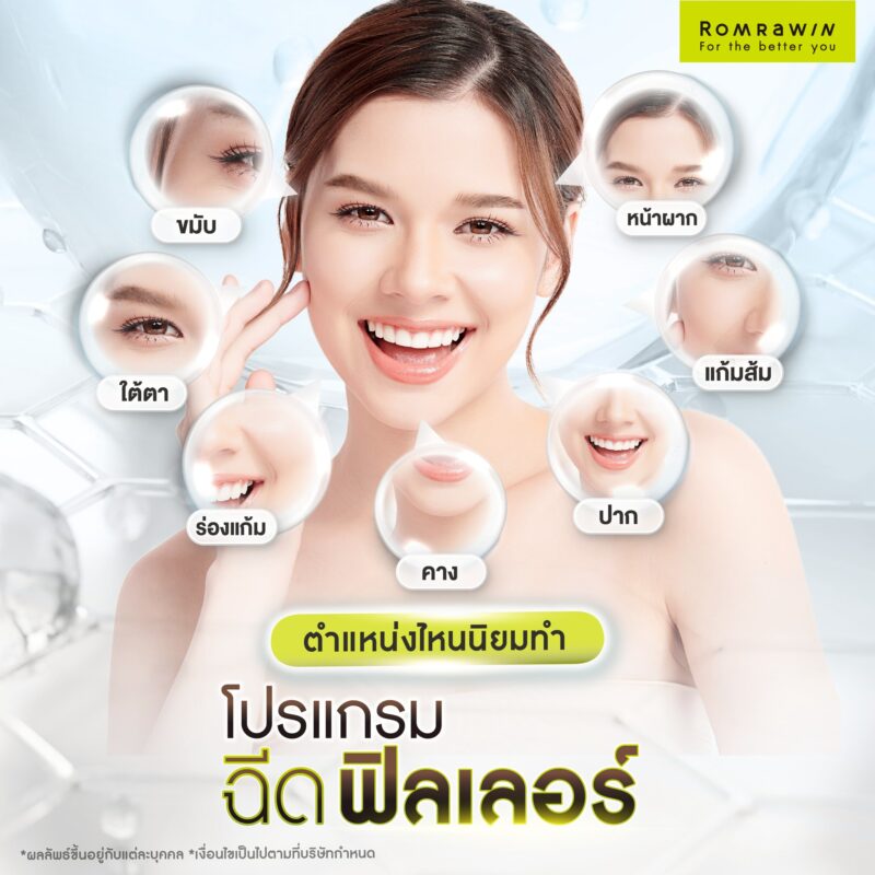 ตำแหน่งที่นิยมฉีดฟิลเลอร์