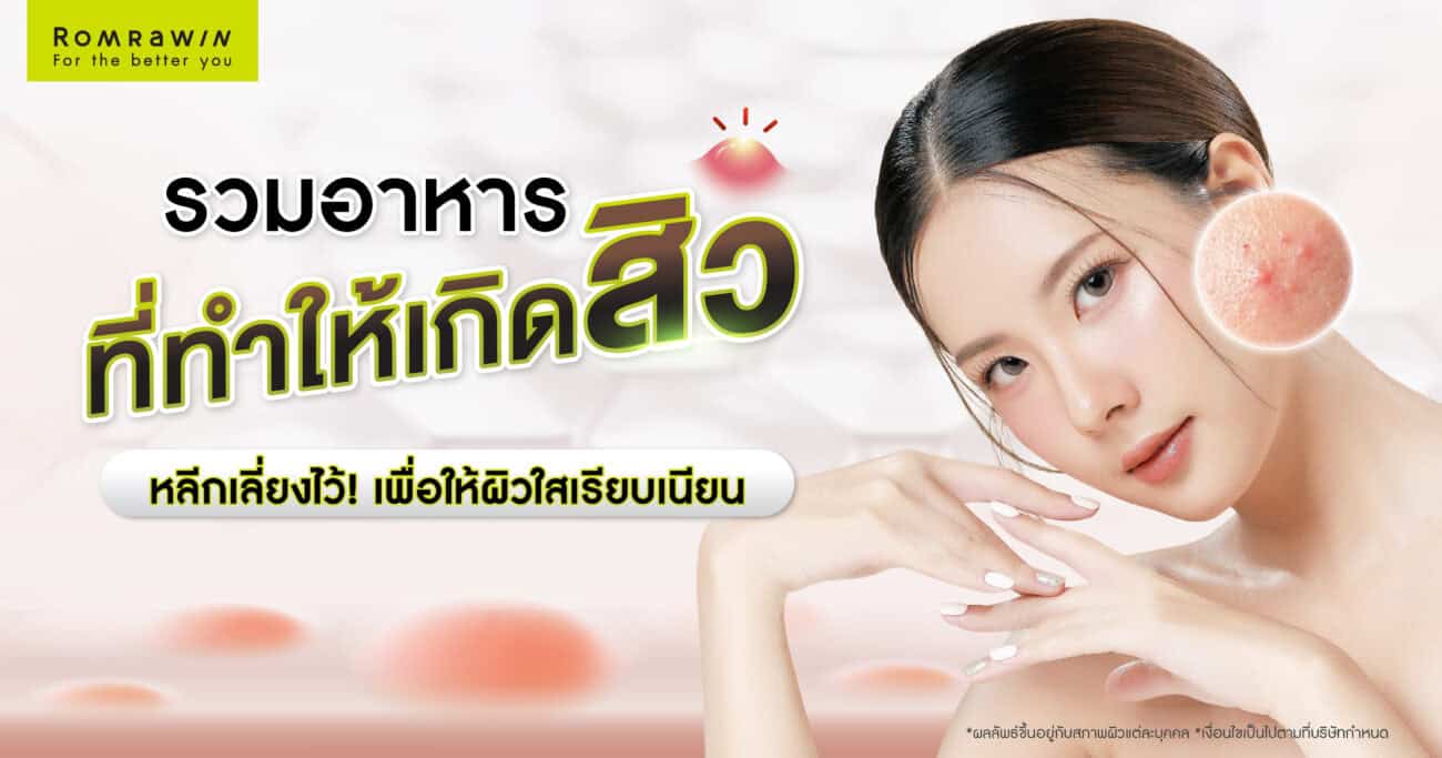 อาหารที่ทำให้เกิดสิว