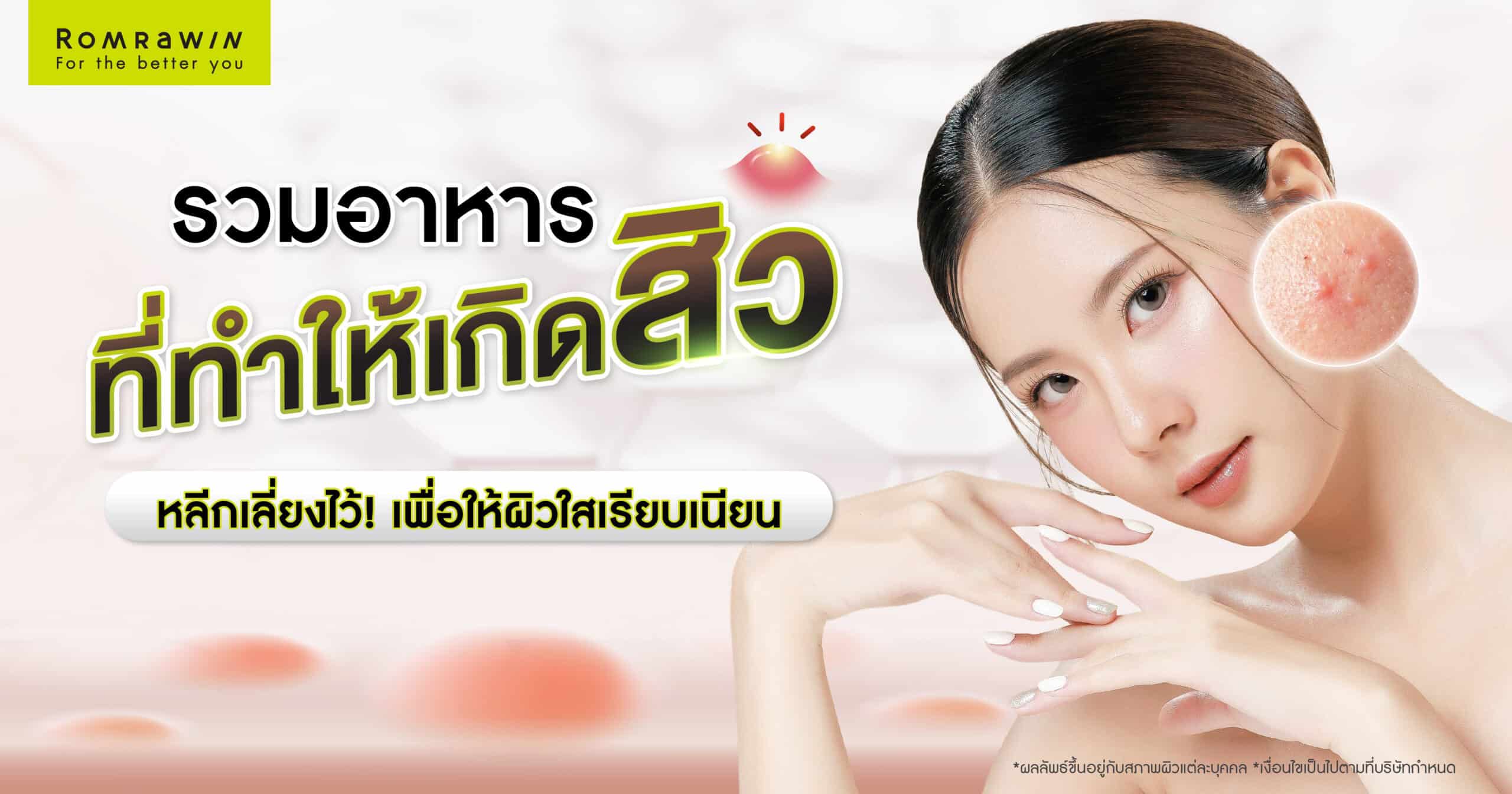 อาหารที่ทำให้เกิดสิว