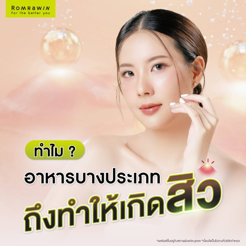 ทำไมอาหารบางประเภทถึงทำให้เกิดสิว