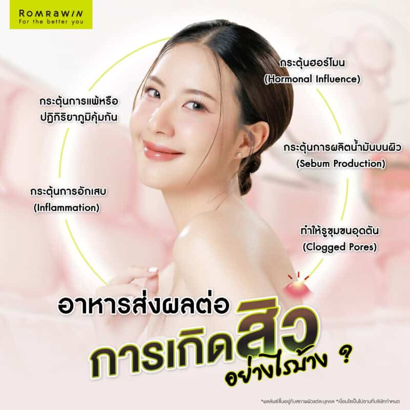 อาหารส่งผลต่อการเกิดสิวอย่างไรบ้าง ?