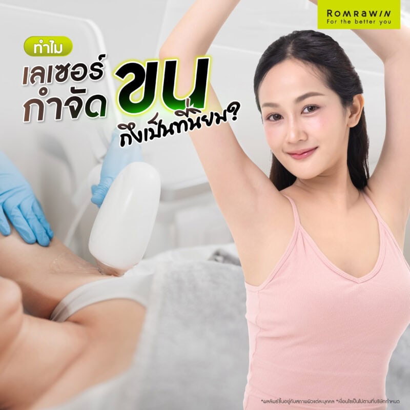 กำจัดขนแบบไหนดี ? รวมวิธียอดนิยมและข้อควรรู้ก่อนตัดสินใจ 5 ทำไมเลเซอร์กำจัดขนถึงเป็นที่นิยม