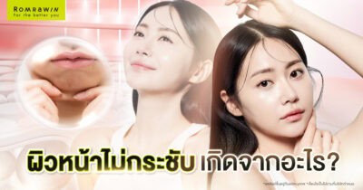 แก้ปัญหาผิวหย่อนคล้อย