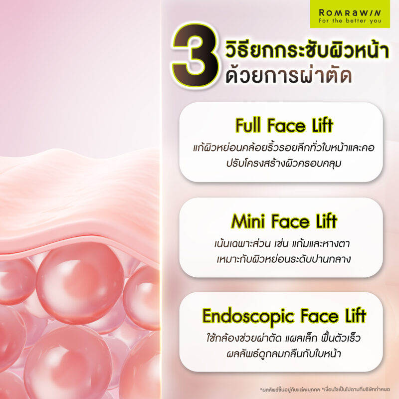 การยกกระชับผิวหน้าหย่อนคล้อยด้วยการผ่าตัด