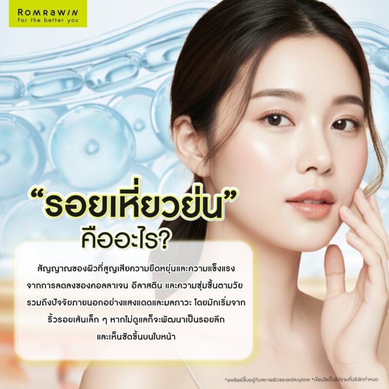 รอยเหี่ยวย่นคืออะไร?