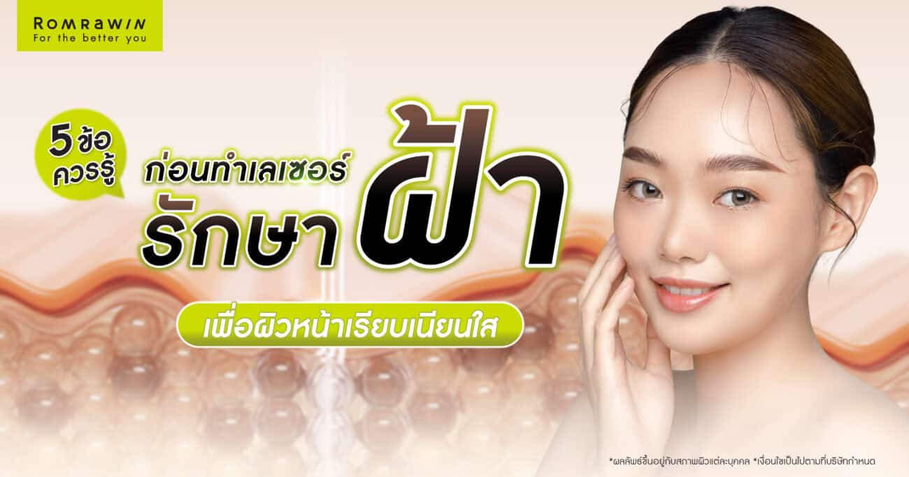 เลเซอร์รักษาฝ้า