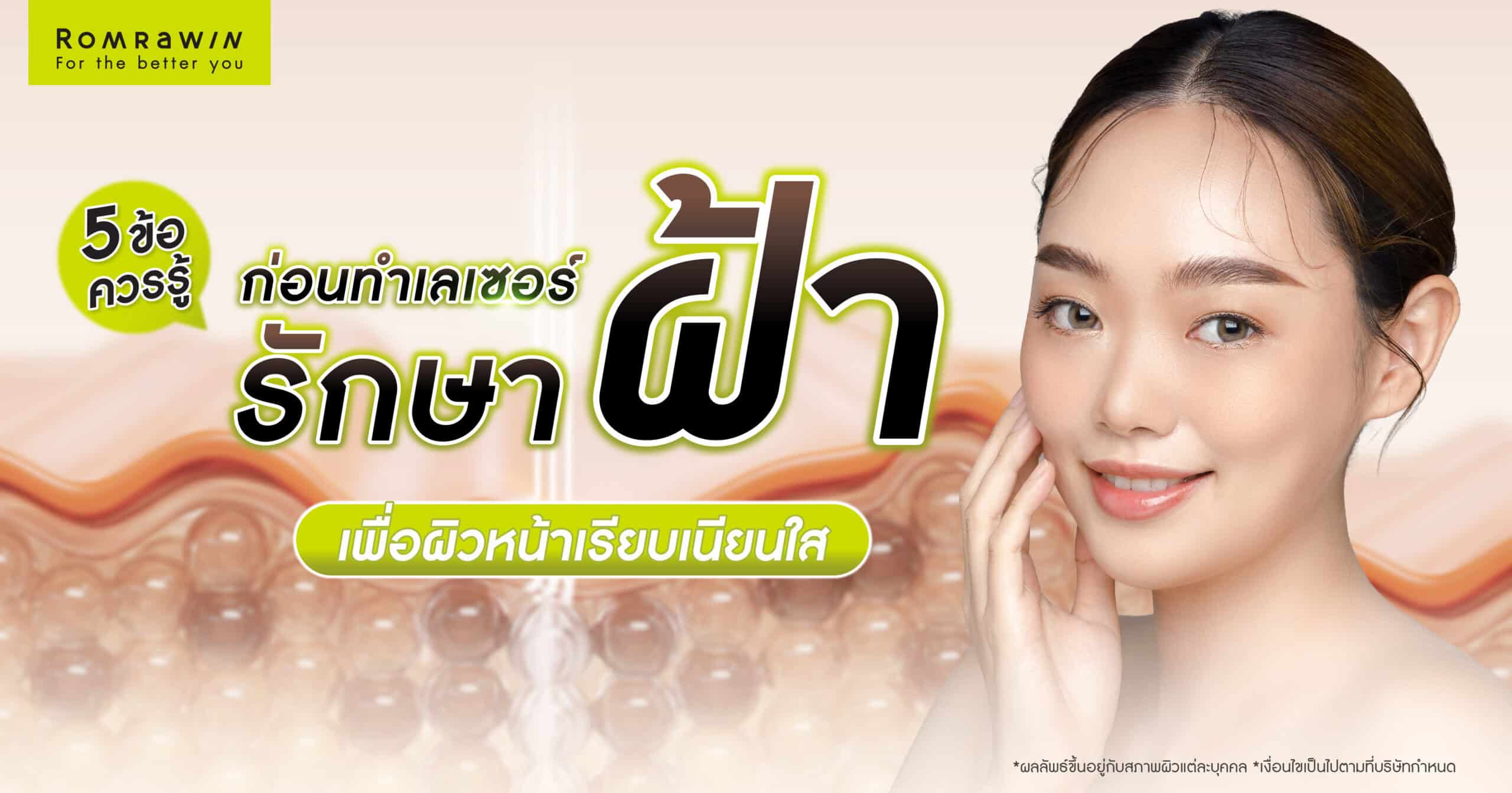 เลเซอร์รักษาฝ้า