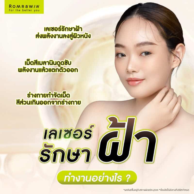 เลเซอร์รักษาฝ้า ทำงานอย่างไร ?