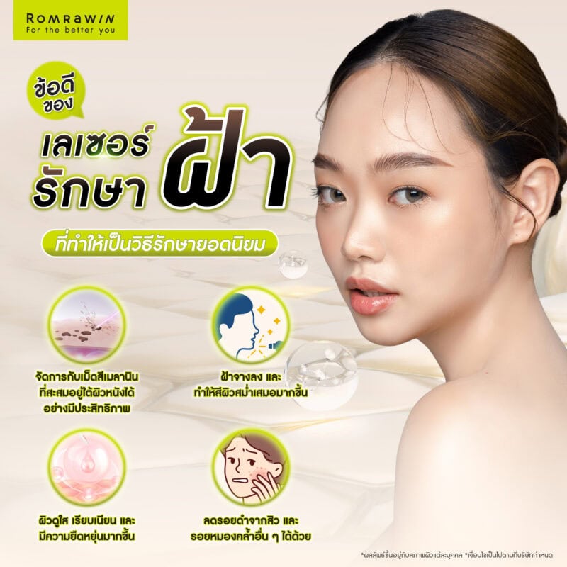 ข้อดีของเลเซอร์รักษาฝ้า ที่ทำให้เป็นวิธีรักษายอดนิยม