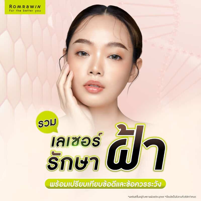 รวมเลเซอร์รักษาฝ้า พร้อมเปรียบเทียบข้อดี–ข้อควรระวังของแต่ละประเภท