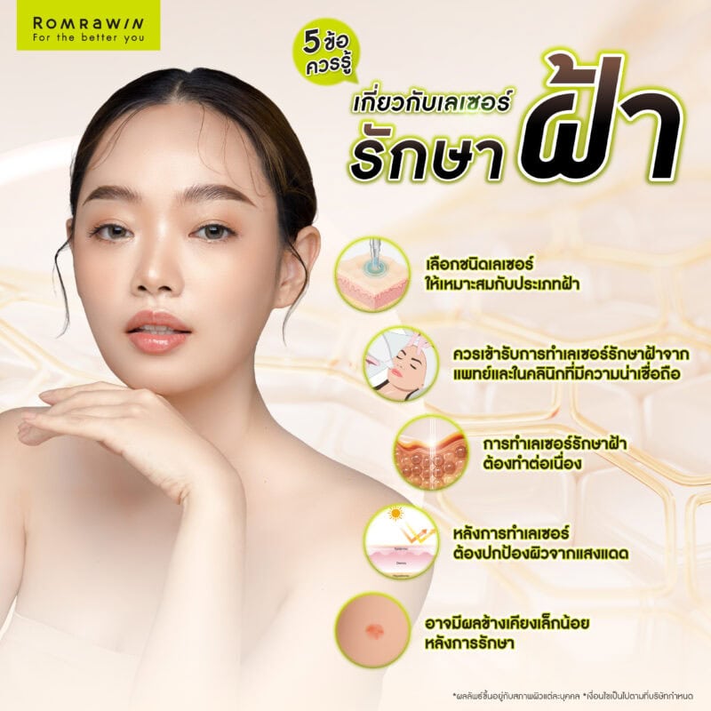 5 ข้อควรรู้เกี่ยวกับเลเซอร์รักษาฝ้า