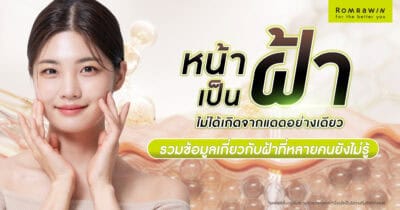 หน้าเป็นฝ้า