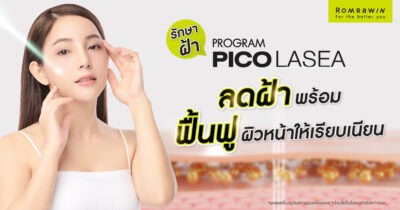 รักษาฝ้าด้วย Pico Laser
