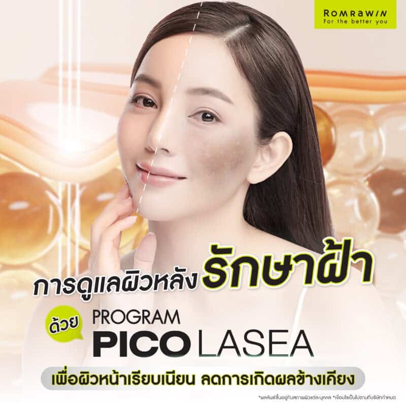 การดูแลผิวหลังรักษาฝ้าด้วย Pico Laser เพื่อผิวหน้าเรียบเนียน ลดการเกิดผลข้างเคียง