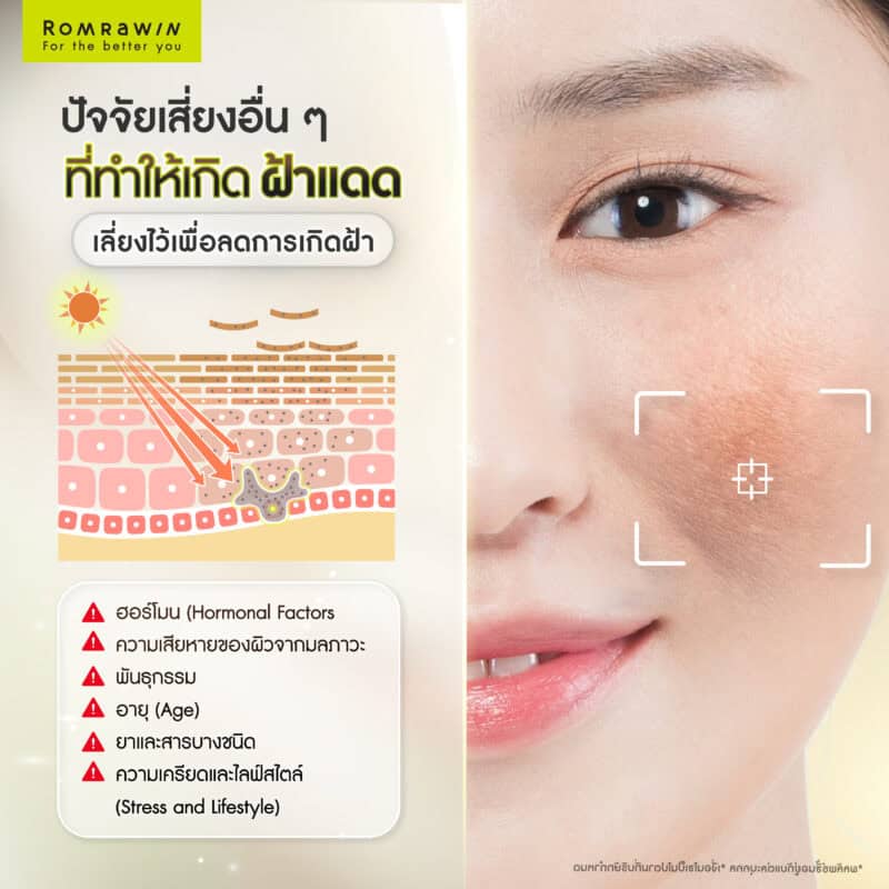 ปัจจัยเสี่ยงอื่น ๆ ที่ทำให้เกิดฝ้าแดด เลี่ยงไว้เพื่อลดการเกิดฝ้า