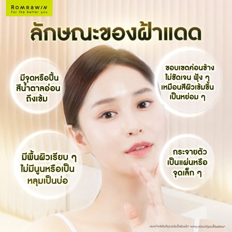 ลักษณะของฝ้าแดด